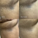 240731_TOPICALS_Faded_Cleansing_Bar_B_A_GRID_4_5_2_1100x