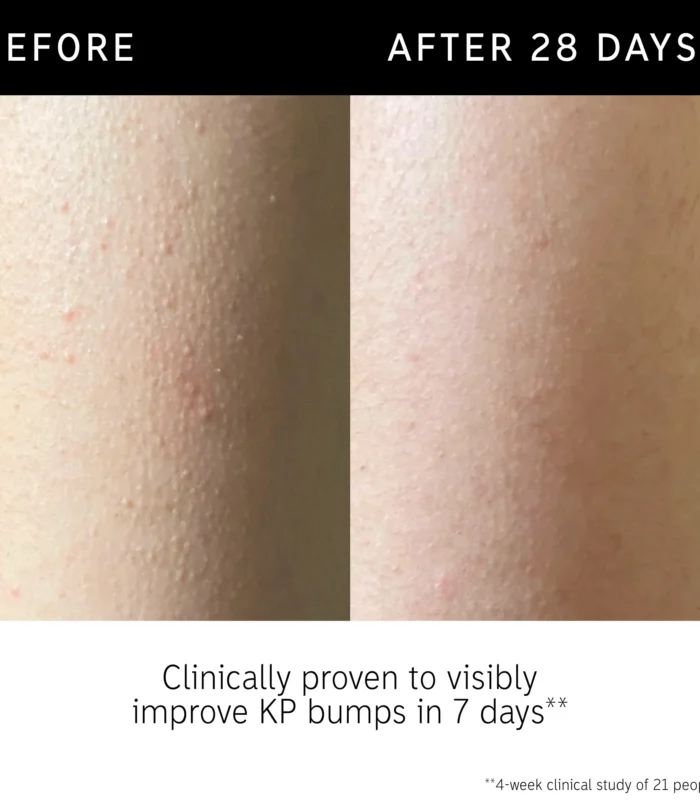 DTC-Top15_Amends_Glycolic-KP_B_A_3200x_crop_center DTC-Top15_Amends_Glycolic-KP_B_A_3200x_crop_center