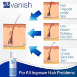 VANISH-PFB-Chromabright-Soin-post-2