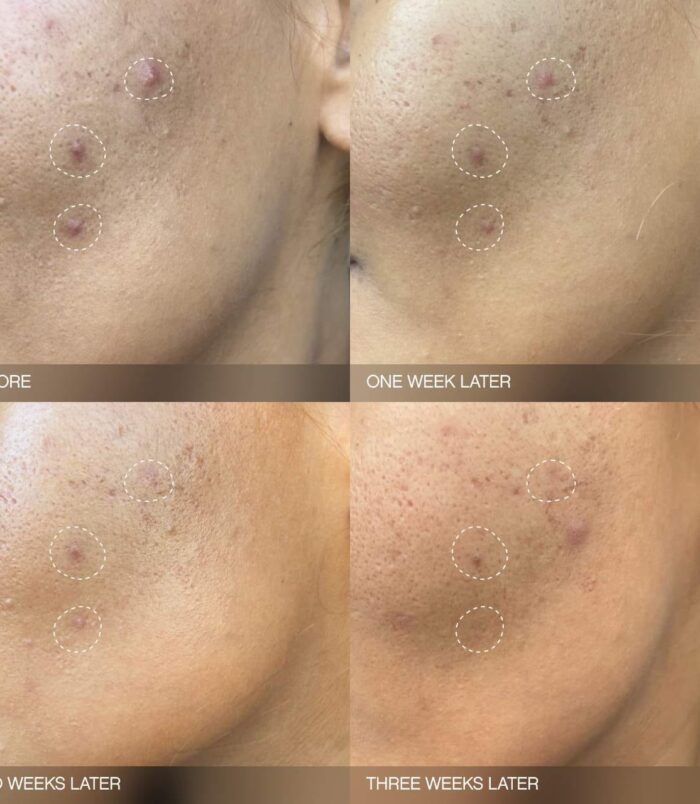 s2875771-av-2-zoom s2875771-av-2-zoom