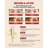before-after-eye-cream