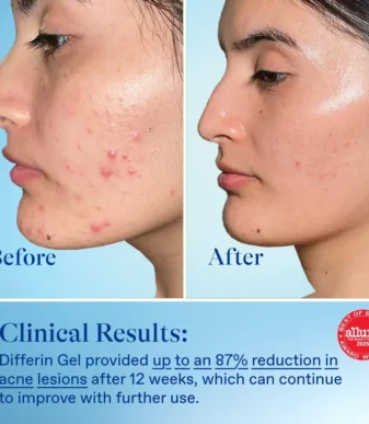 869b1f92-9dea-4cc1-b4ea-212d35cb5e02.38d752cffb1b9ab628923c74b12faefa